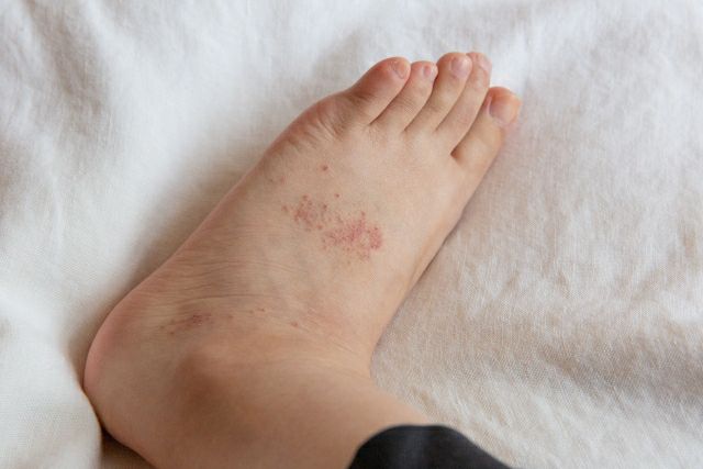 医療用医薬品